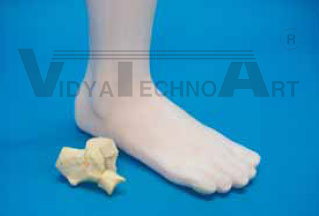 Foot 4-part, fractured, foam coat 90°